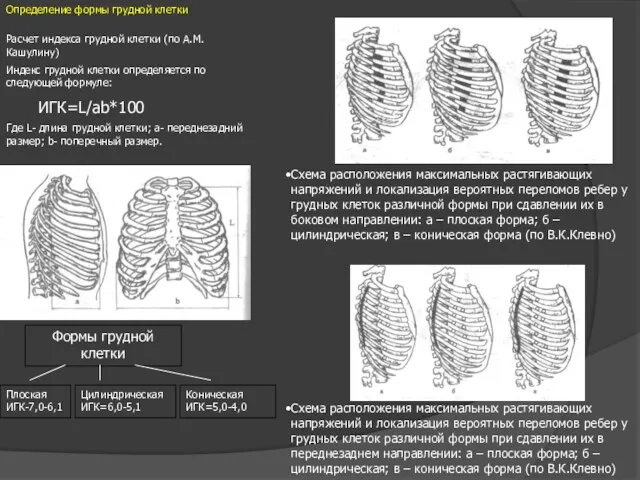 Определение формы грудной клетки Расчет индекса грудной клетки (по А.М.Кашулину)