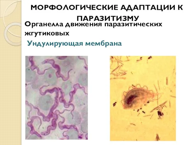 Органелла движения паразитических жгутиковых Ундулирующая мембрана МОРФОЛОГИЧЕСКИЕ АДАПТАЦИИ К ПАРАЗИТИЗМУ