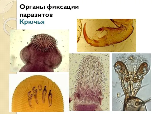 Органы фиксации паразитов Крючья