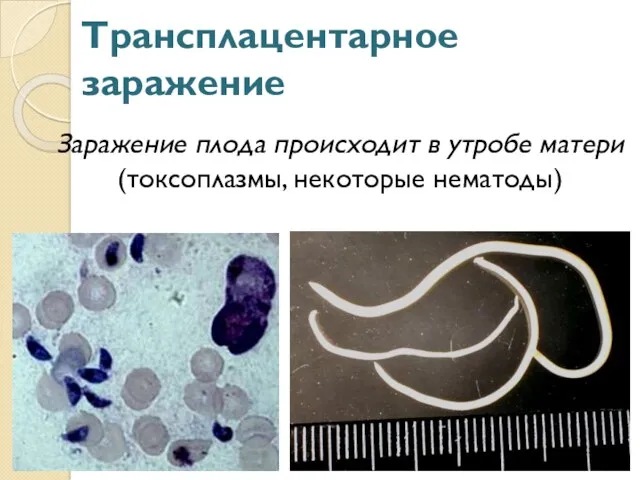 Трансплацентарное заражение Заражение плода происходит в утробе матери (токсоплазмы, некоторые нематоды)