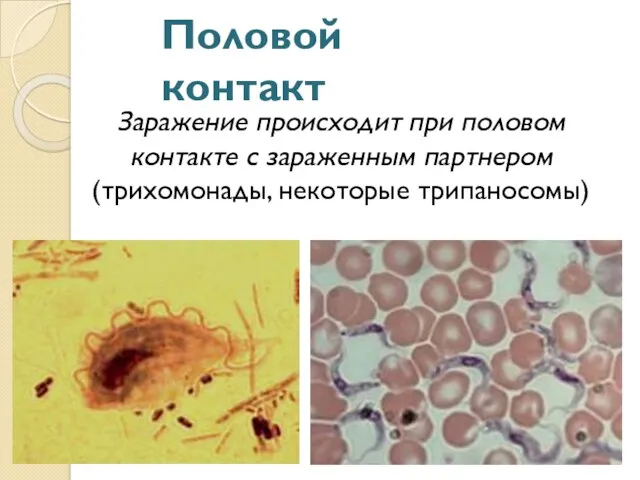 Половой контакт Заражение происходит при половом контакте с зараженным партнером (трихомонады, некоторые трипаносомы)