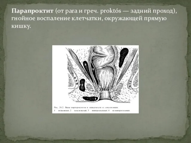 Парапроктит (от para и греч. proktós — задний проход), гнойное воспаление клетчатки, окружающей прямую кишку.