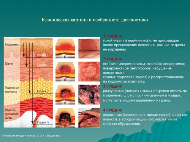 Инновации вуходе • ноябрь 2012 • г. Владимир Клиническая картина