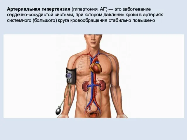 Артериальная гипертензия (гипертония, АГ) — это заболевание сердечно-сосудистой системы, при