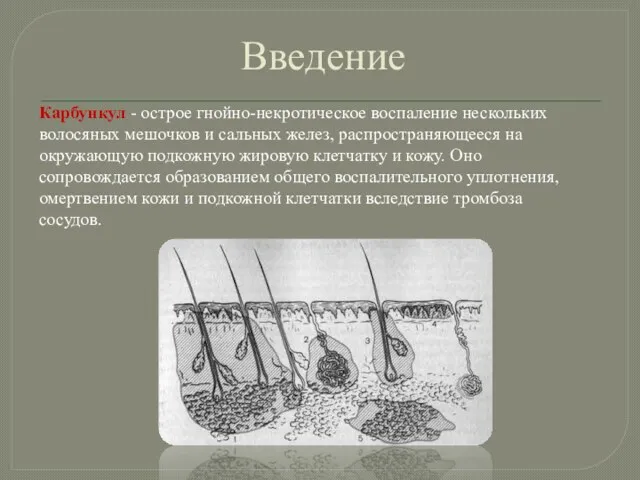 Введение Карбункул - острое гнойно-некротическое воспаление нескольких волосяных мешочков и