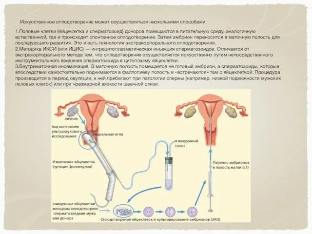 Искусственное оплодотворение может осуществляться несколькими способами: 1.Половые клетки (яйцеклетка и