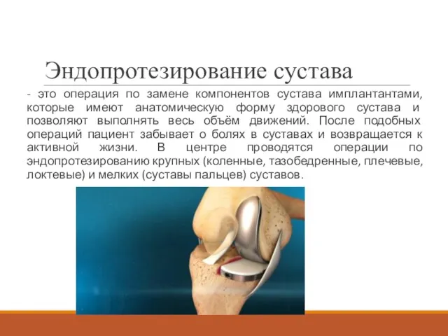 Эндопротезирование сустава - это операция по замене компонентов сустава имплантантами,