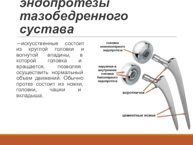 Современные эндопротезы тазобедренного сустава —искусственные состоит из круглой головки и вогнутой впадины, в