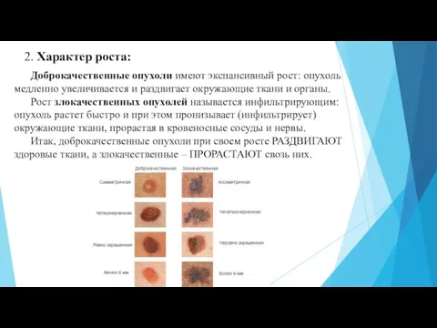 2. Характер роста: Доброкачественные опухоли имеют экспансивный рост: опухоль медленно