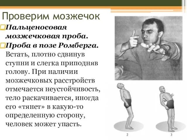 Пальценосовая мозжечковая проба. Проба в позе Ромберга. Встать, плотно сдвинув