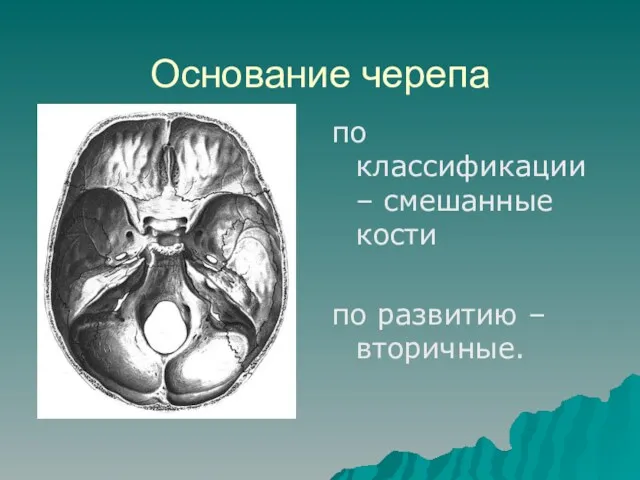 Основание черепа по классификации – смешанные кости по развитию – вторичные.