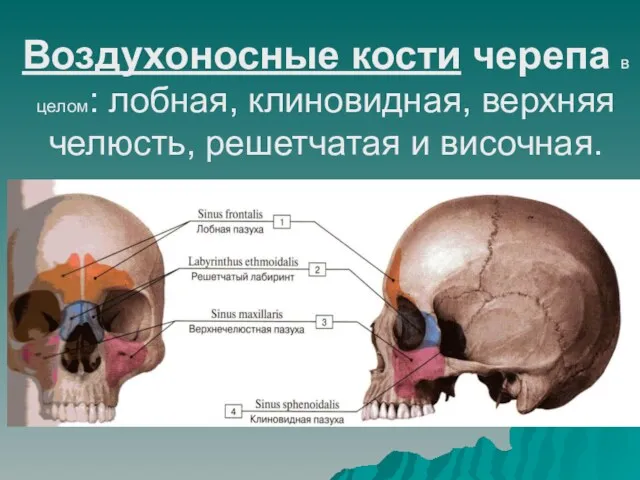 Воздухоносные кости черепа в целом: лобная, клиновидная, верхняя челюсть, решетчатая и височная.
