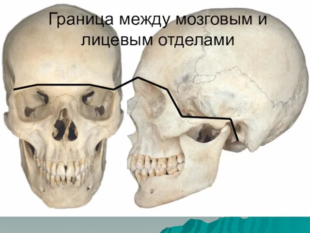 Граница между мозговым и лицевым отделами