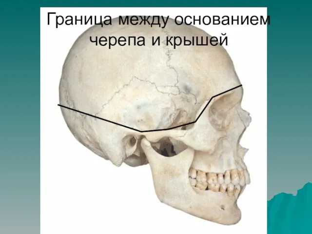 Граница между основанием черепа и крышей