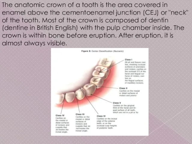 The anatomic crown of a tooth is the area covered