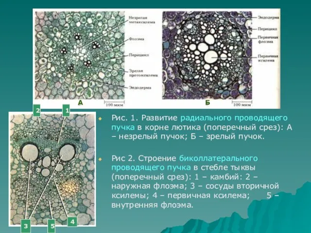 Рис. 1. Развитие радиального проводящего пучка в корне лютика (поперечный