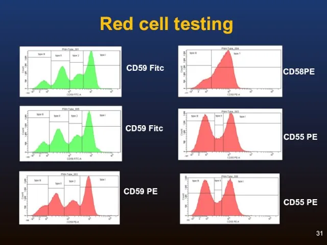 Red cell testing CD58PE CD55 PE CD55 PE CD59 Fitc CD59 PE CD59 Fitc