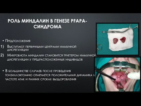 РОЛЬ МИНДАЛИН В ГЕНЕЗЕ PFAPA-СИНДРОМА Предположения Выступают первичными центрами иммунной