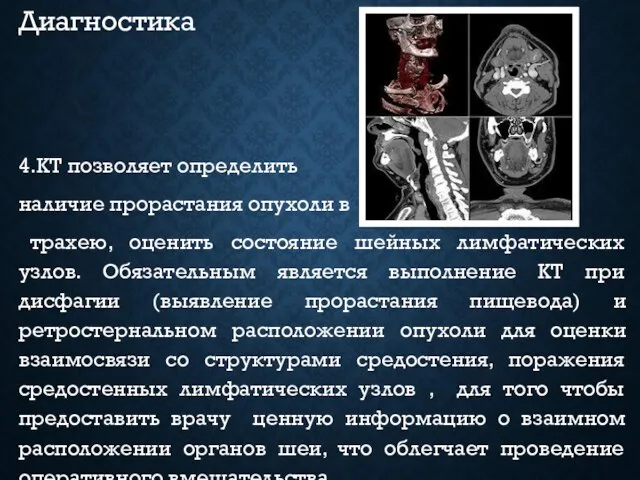 Диагностика 4.КТ позволяет определить наличие прорастания опухоли в трахею, оценить