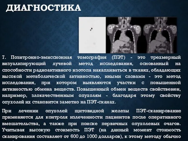 ДИАГНОСТИКА 7. Позитронно-эмиссионная томография (ПЭТ) - это трехмерный визуализирующий лучевой