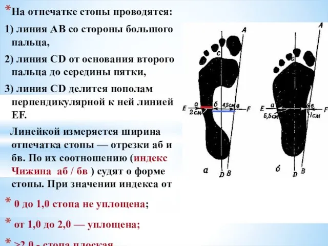 На отпечатке стопы проводятся: 1) линия АВ со стороны большого