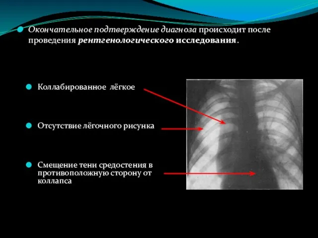 Окончательное подтверждение диагноза происходит после проведения рентгенологического исследования. Коллабированное лёгкое