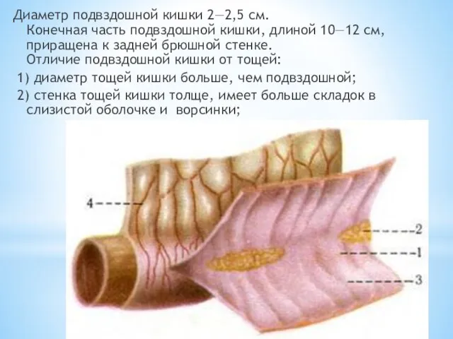 Диаметр подвздошной кишки 2—2,5 см. Конечная часть подвздошной кишки, длиной