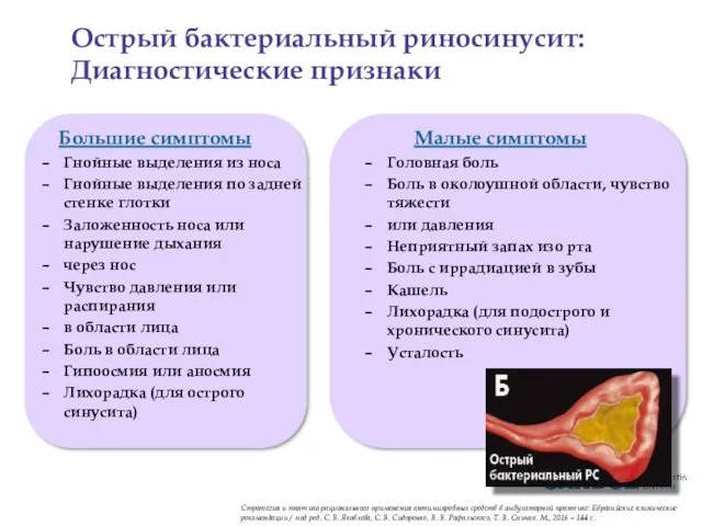 Большие симптомы Гнойные выделения из носа Гнойные выделения по задней