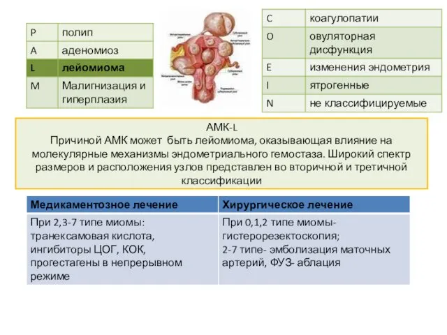 АМК-L Причиной АМК может быть лейомиома, оказывающая влияние на молекулярные