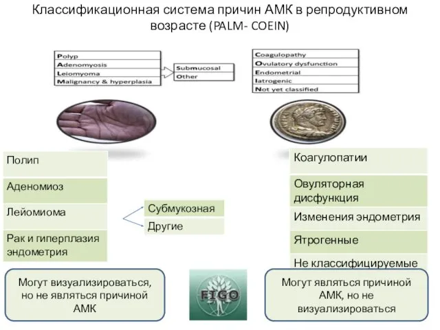 Классификационная система причин АМК в репродуктивном возрасте (PALM- COEIN) Могут