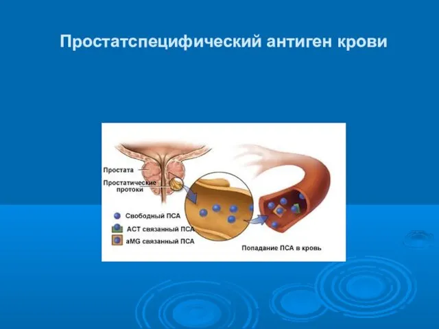 Простатспецифический антиген крови