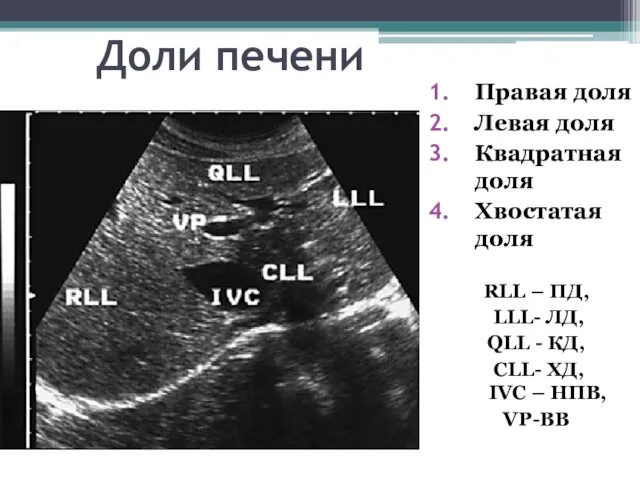 Доли печени Правая доля Левая доля Квадратная доля Хвостатая доля
