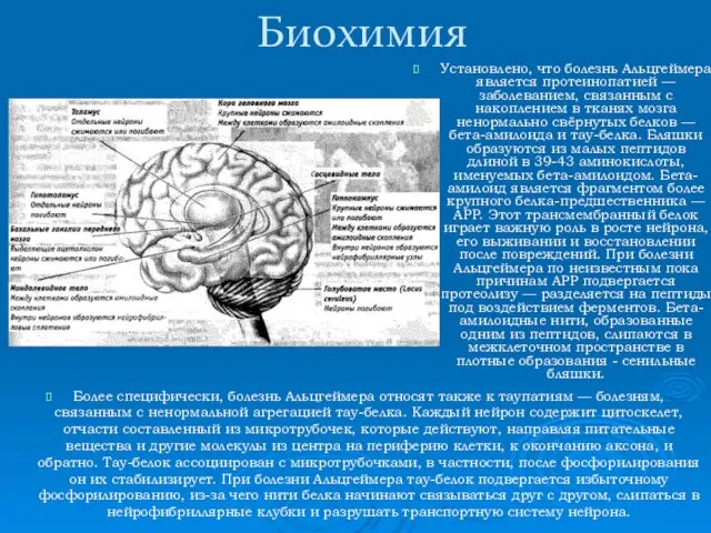 Биохимия Установлено, что болезнь Альцгеймера является протеинопатией — заболеванием, связанным