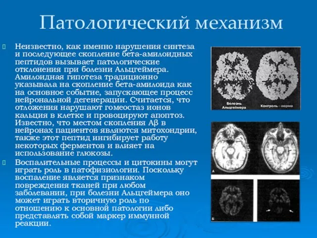 Патологический механизм Неизвестно, как именно нарушения синтеза и последующее скопление