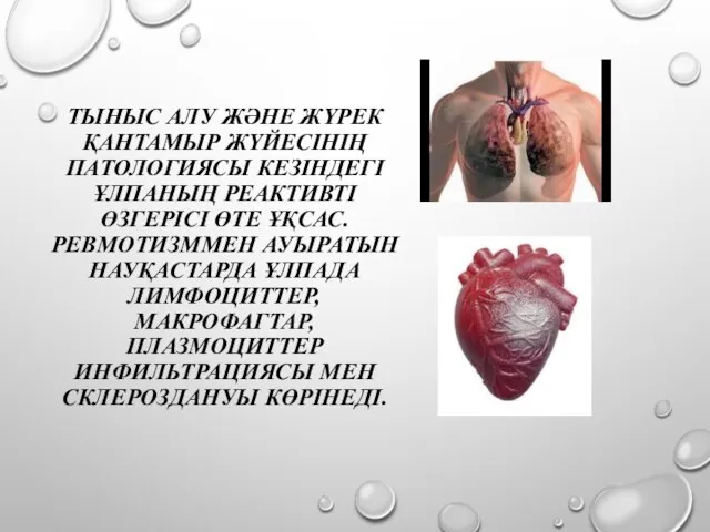 ТЫНЫС АЛУ ЖӘНЕ ЖҮРЕК ҚАНТАМЫР ЖҮЙЕСІНІҢ ПАТОЛОГИЯСЫ КЕЗІНДЕГІ ҰЛПАНЫҢ РЕАКТИВТІ ӨЗГЕРІСІ ӨТЕ ҰҚСАС.РЕВМОТИЗММЕН