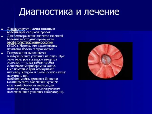 Диагностика и лечение Диагностирует и лечит язвенную болезнь врач-гастроэнтеролог. Для