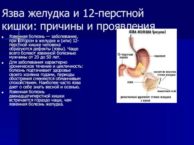 Язва желудка и 12-перстной кишки: причины и проявления Язвенная болезнь