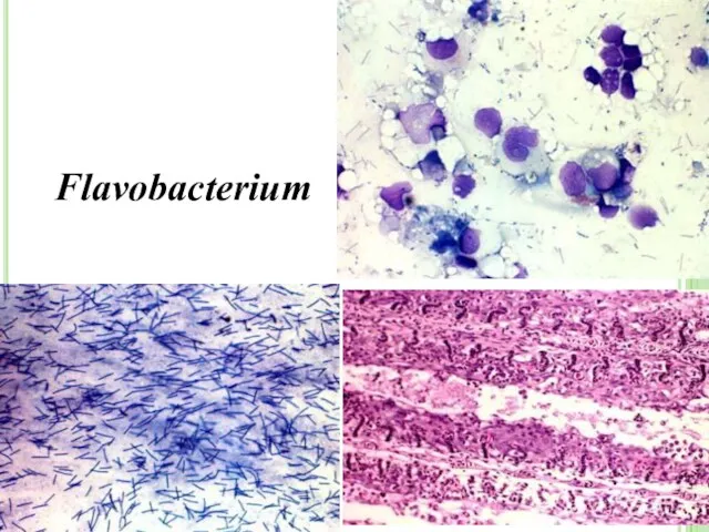 Flavobacterium