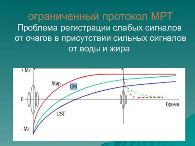 ограниченный протокол МРТ Проблема регистрации слабых сигналов от очагов в