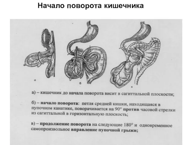 Начало поворота кишечника