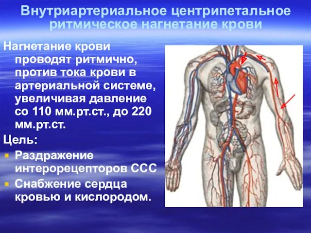 Внутриартериальное центрипетальное ритмическое нагнетание крови Нагнетание крови проводят ритмично, против