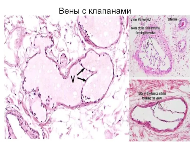 Вены с клапанами