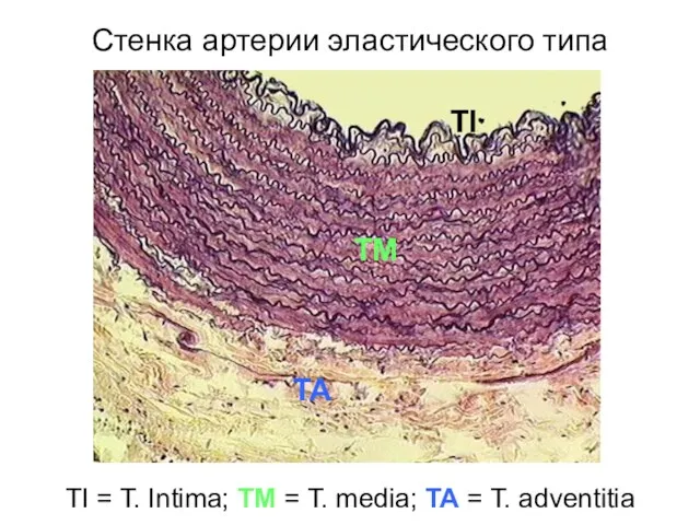 Стенка артерии эластического типа TI = T. Intima; TM =