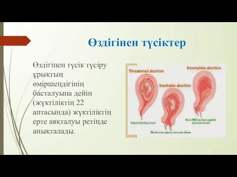 Өздігінен түсіктер Өздігінен түсік түсіру ұрықтың өміршеңдігінің басталуына дейін (жүктіліктің 22 аптасында) жүктіліктің