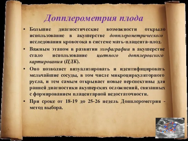 Допплерометрия плода Большие диагностические возможности открыло использование в акушерстве допплерометрического