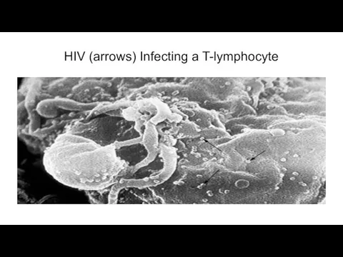 HIV (arrows) Infecting a T-lymphocyte