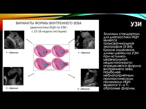 УЗИ Золотым стандартом для диагностики ИЦН является трансвагинальная эхография (УЗИ).
