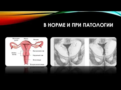 В НОРМЕ И ПРИ ПАТОЛОГИИ