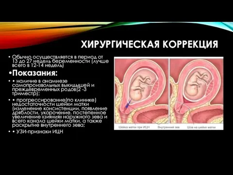 ХИРУРГИЧЕСКАЯ КОРРЕКЦИЯ Обычно осуществляется в период от 13 до 27