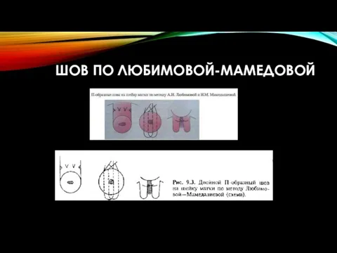 ШОВ ПО ЛЮБИМОВОЙ-МАМЕДОВОЙ